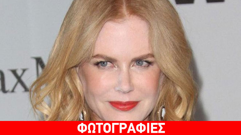 Nicole Kidman: Έπεσε πολύ παραπάνω η πούδρα και ιδού το αποτέλεσμα!