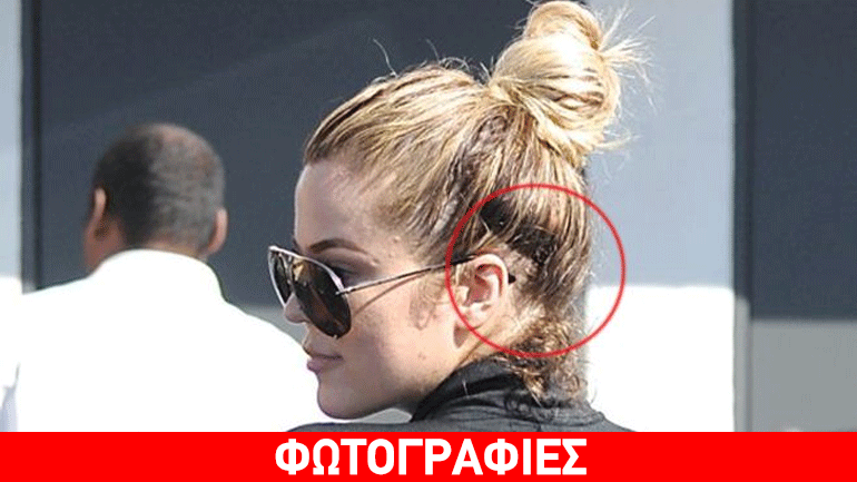 Khloe Kardashian: «Πληρώνει» το τίμημα των πρόσθετων μαλλιών!