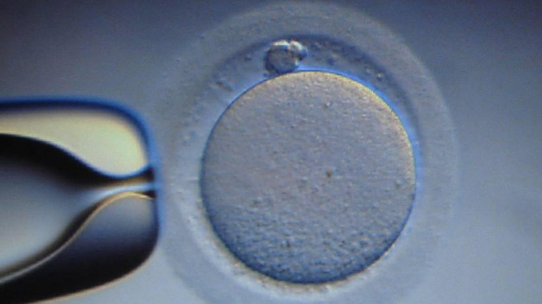 Νέα μέθοδος εξωσωματικής γονιμοποίησης με χαμηλότερο κόστος