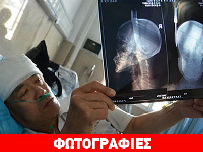 Μαχαίρι έπεσε από τον… ουρανό και καρφώθηκε στο κεφάλι του