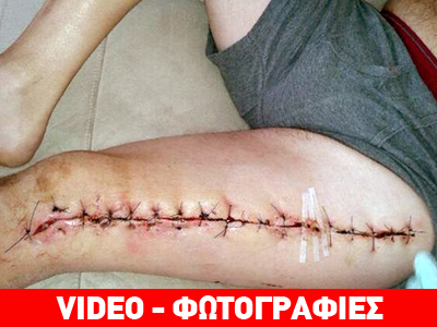 Βρετανία: Παρ’ ολίγον νεκρός από τεράστια αράχνη Βρετανία: Παρ’ ολίγον νεκρός από τεράστια αράχνη