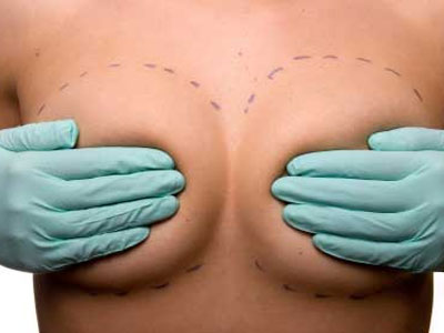 Αυξητική στήθους Αυξητική στήθους