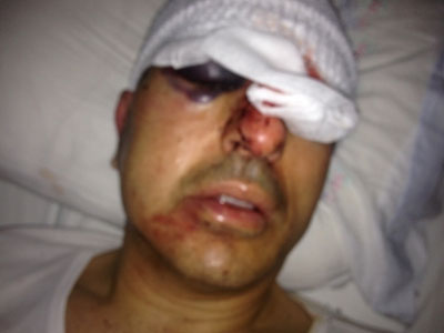 Απειλές δέχθηκε και άλλος αντιδήμαρχος εκτός από τον Ινιωτάκη