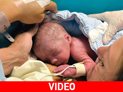 Η πρώτη φωτογραφία του βρέφους που γεννήθηκε έπειτα από μεταμόσχευση μήτρας