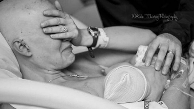 Μητέρα θηλάζει τον γιο της ύστερα από μαστεκτομή