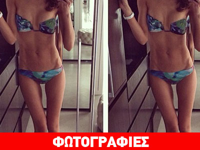 Μοντέλο στα όρια της ανορεξίας προκάλεσε σάλο στα social media