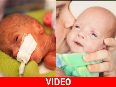 Ένα συγκινητικό βίντεο: Οι πρώτες 80 ημέρες ενός πρόωρου βρέφους