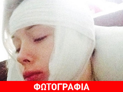 Θύμα επίθεσης η «ανθρώπινη barbie»