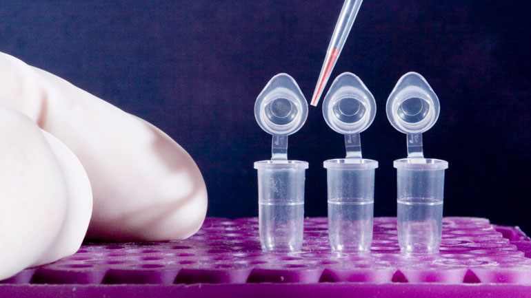 Ασυμπτωματικό ουρεόπλασμα: Ποια είναι η κατάλληλη θεραπεία;