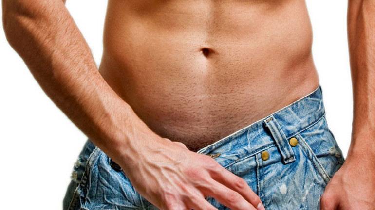 «Κάμψη του πέους κατά τη διάρκεια της στύσης»