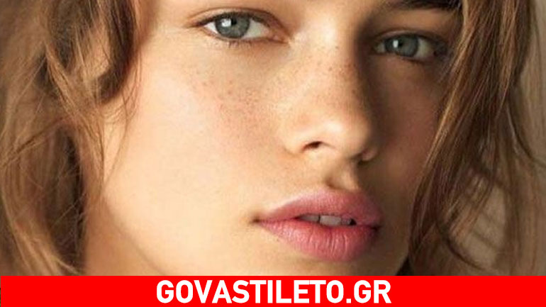 Πανάδες από τον ήλιο; Σας έχουμε την τέλεια φυσική συνταγή για να τις εξαφανίσετε