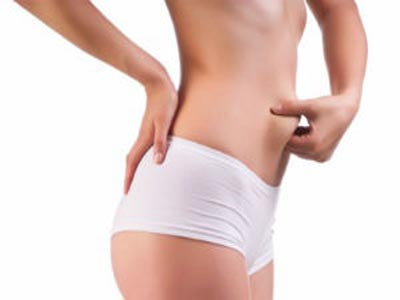 Smart Lipo: Νέα τεχνική λιποαναρρόφησης