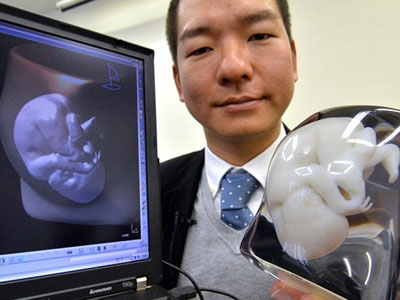 Το έμβρυο σε… εικόνα 3D!