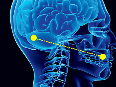 Η γλωσσομάθεια καθυστερεί την Αλτσχάιμερ