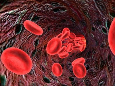 Αναιμία και διατροφή