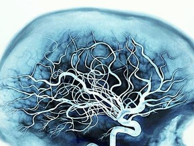 Και ο εγκέφαλος χρειάζεται τη γυμναστική του!