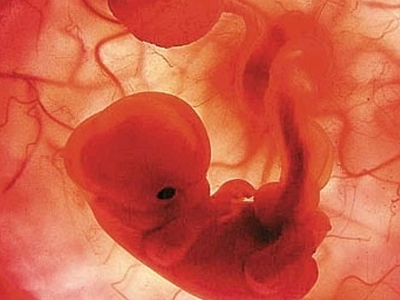 Θεραπεία γενετικών ασθενειών… πριν από τη γέννηση