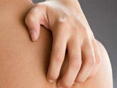 Η φαγούρα είναι κολλητική!