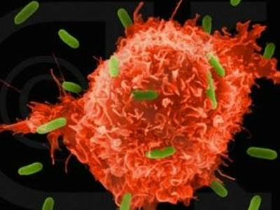 Τα οκτώ συμπτώματα που μπορεί να σημαίνουν καρκίνο