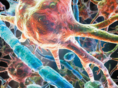 Νέα μέθοδος κατά των καρκινικών κυττάρων