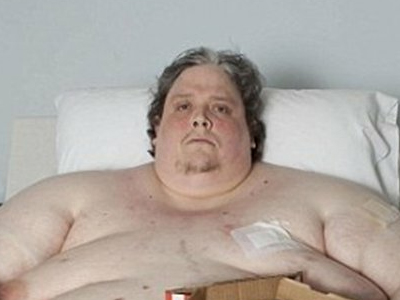 Παχύσαρκος αλλά υγιής;