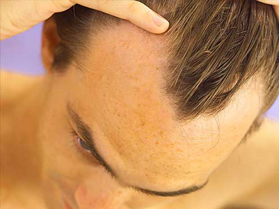 Δέκα τροφές κατά της τριχόπτωσης