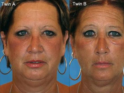 Δείτε γιατί πρέπει να κόψετε το τσιγάρο… σήμερα!