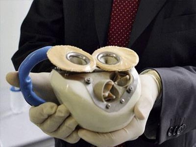 Απεβίωσε ο ασθενής με την πρώτη τεχνητή καρδιά