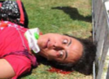 Βαριά τραυματισμένη μία τουρίστρια