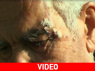 Τον πυροβόλησαν μέσα στο σπίτι του