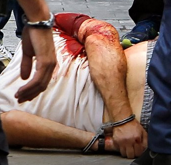 Πέρασαν χειροπέδες στον τραυματισμένο Μαζιώτη