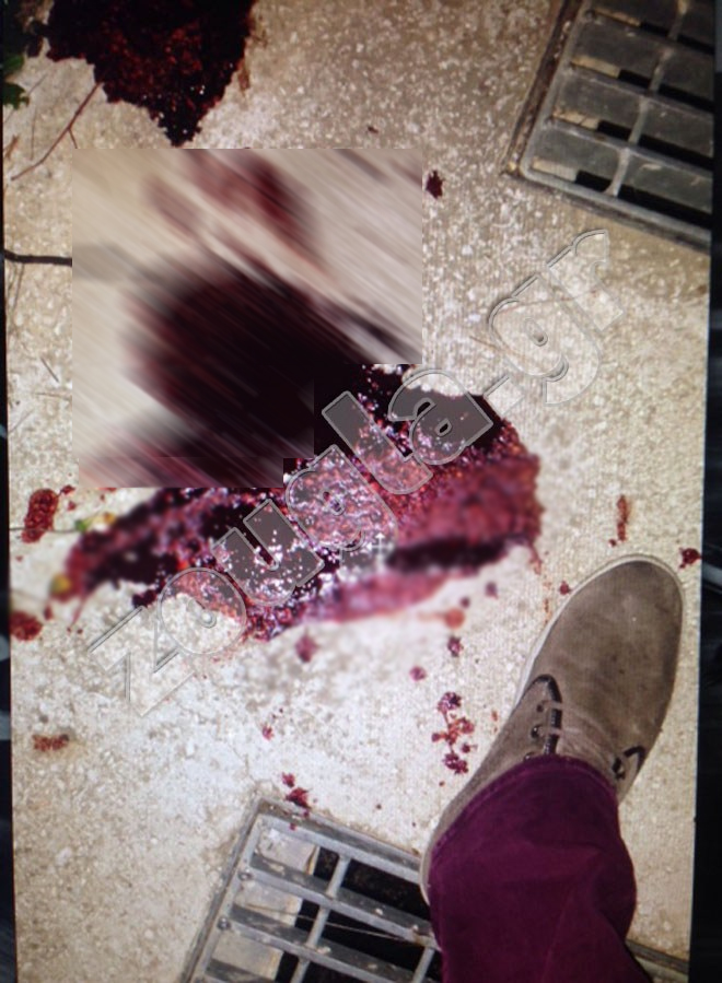 Η στιγμή του τραυματισμού