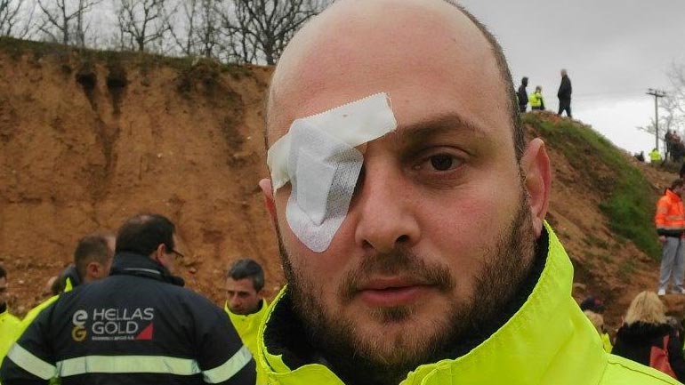 Τραυματισμένος εργαζόμενος στα μεταλλεία