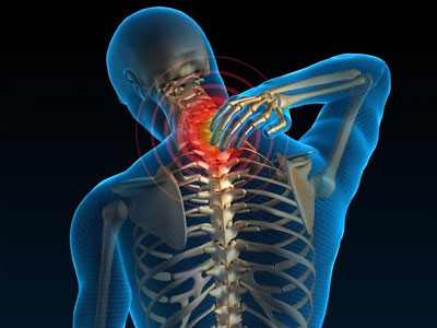 Αυχενικό σύνδρομο: Πώς αντιμετωπίζεται;