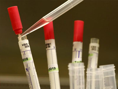 Πίθηκοι που προσβλήθηκαν από Έμπολα θεραπεύτηκαν με πειραματικό φάρμακο