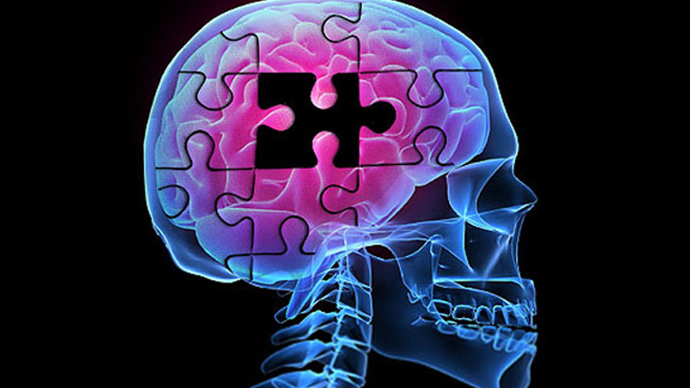 Κάθε 68 δευτερόλεπτα και μια νέα περίπτωση νόσου Alzheimer παγκοσμίως