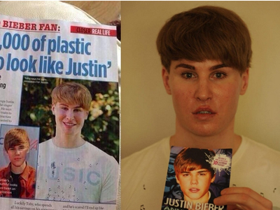 Έκανε πλαστικές για να μοιάσει στον Μπίμπερ!