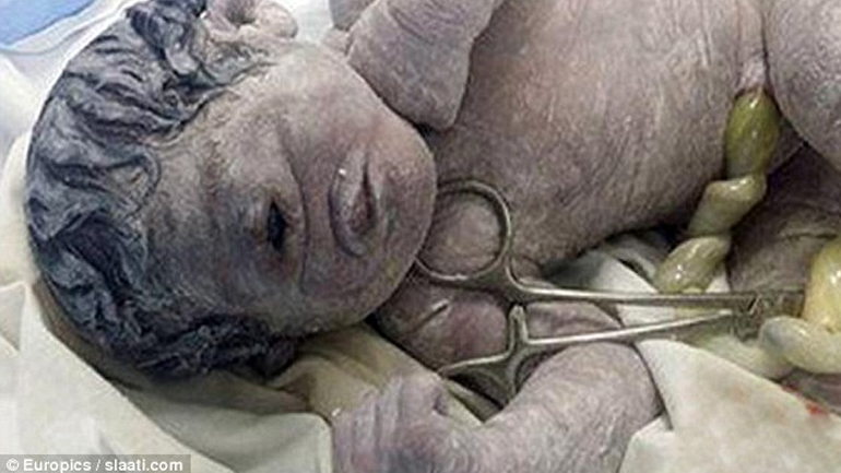 Γεννήθηκε μωρό… Κύκλωπας στην Αίγυπτο