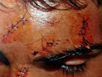 Σοκ για τη ρατσιστική επίθεση