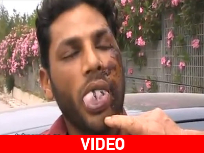 Ξυλοκόπησαν μετανάστη το Πάσχα