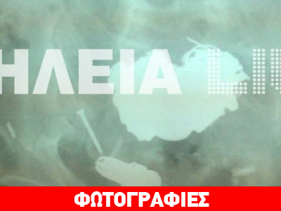 Πύργος: Κατάπιε σφουγγάρι και ένα καρφί