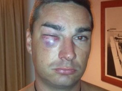 «Mε βασάνισαν και με λήστεψαν αστυνομικοί»