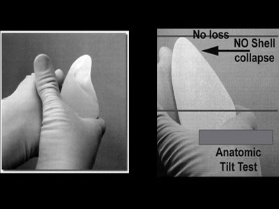 Tα ανατομικά ενθέματα στήθους προτιμούν οι γυναίκες