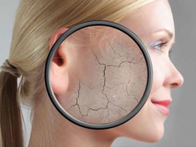 Τα 5 σημάδια της αφυδάτωσης