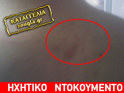 Aστυνομική βία κατά δημοσιογράφου στην Εύβοια