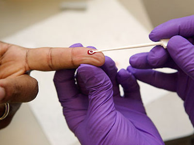 Tεστ για τον ιό του AIDS που θα γίνεται στο σπίτι…