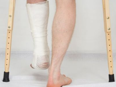 Στο γύψο ο πρώην υφυπουργός