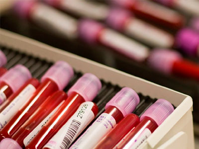 Ανάλυση αίματος μέσα από το… smartphone σας!