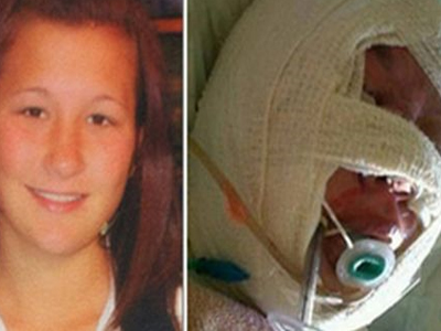 Πέθανε η ομογενής που έπεσε θύμα σατανιστών