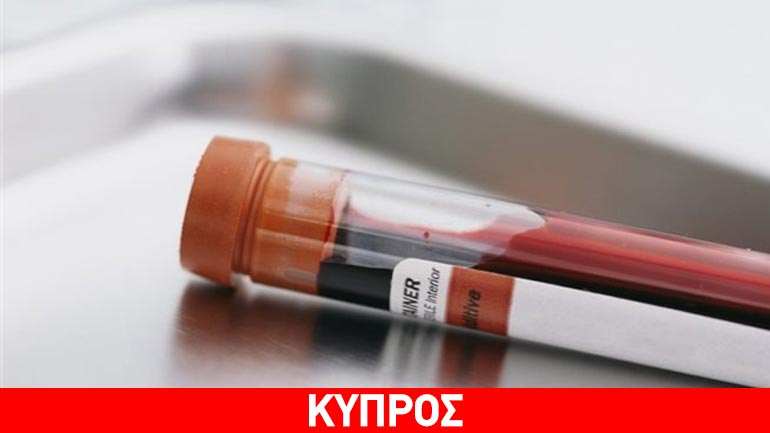 Θανατηφόρο κρούσμα σπογγώδους εγκεφαλοπάθειας στα Κατεχόμενα